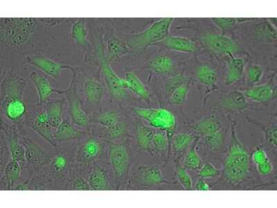 Immunocytochemistry/Immunofluorescence: Lactate Dehydrogenase Antibody [Biotin] [NB600-862] - Tissue: HeLa cells. Fixation: fixed for 5 min in 1:1 MeTOH:Acetone, blocked with incubated with blocking buffer for 15 min. Antigen retrieval: not required. Primary antibody: Lactate Dehydrogenase antibody at 1:200 for 1 h at RT. Secondary antibody: DyLight 488 conjugated Streptavidin antibody at 1:10,000 for 30 min at RT. Staining: Lactate Dehydrogenase as green fluorescent signal.